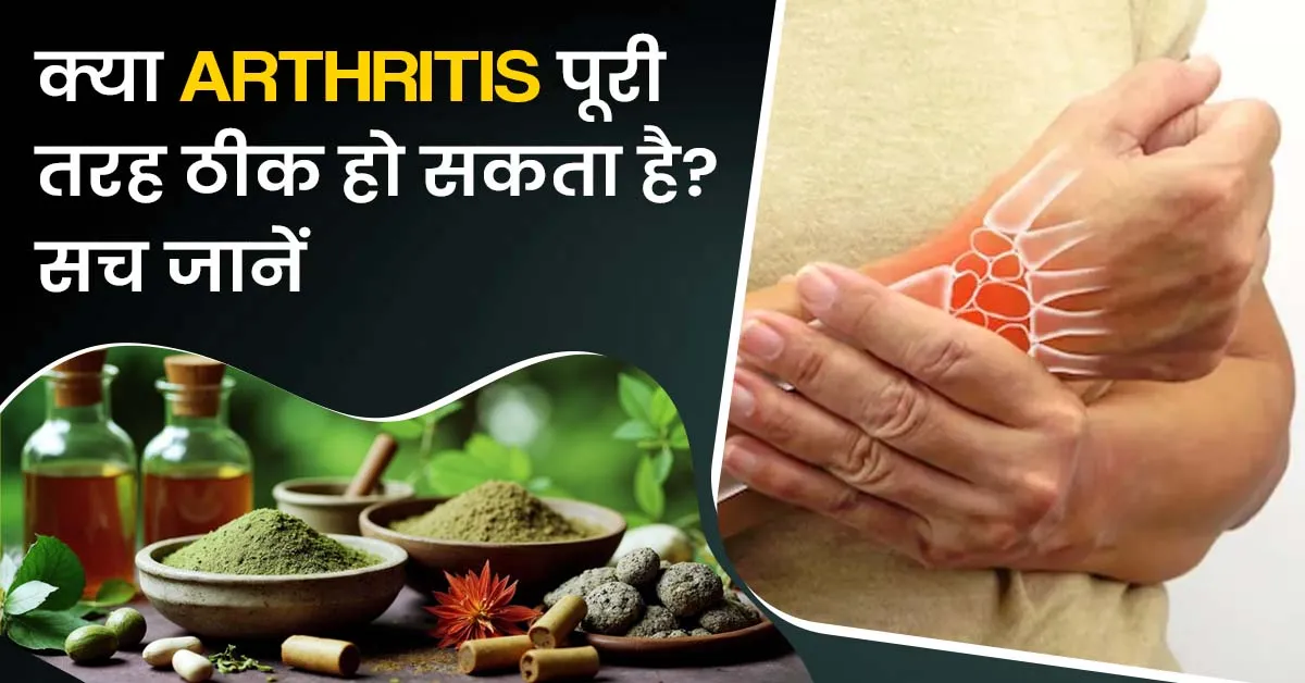 क्या-arthritis-पूरी-तरह-ठीक-हो-सकता-है-सच-जानें
